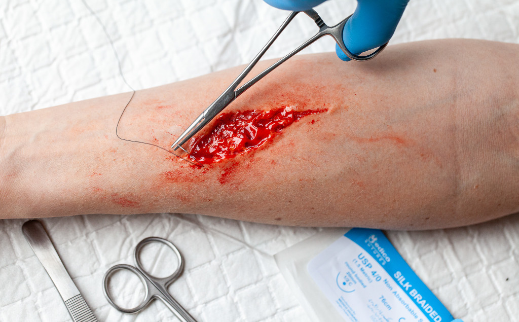 Laceration moulage on a forearm held open with forceps, a suture thread at its edge and scissors, a scalpel and a suture packet alongside