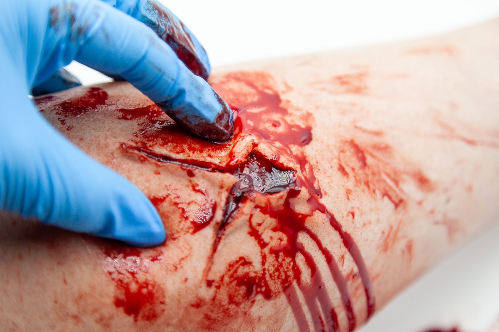 Bleeding incised wound moulage on a limb, a gloved hand working at the wound edge as blood runs from it