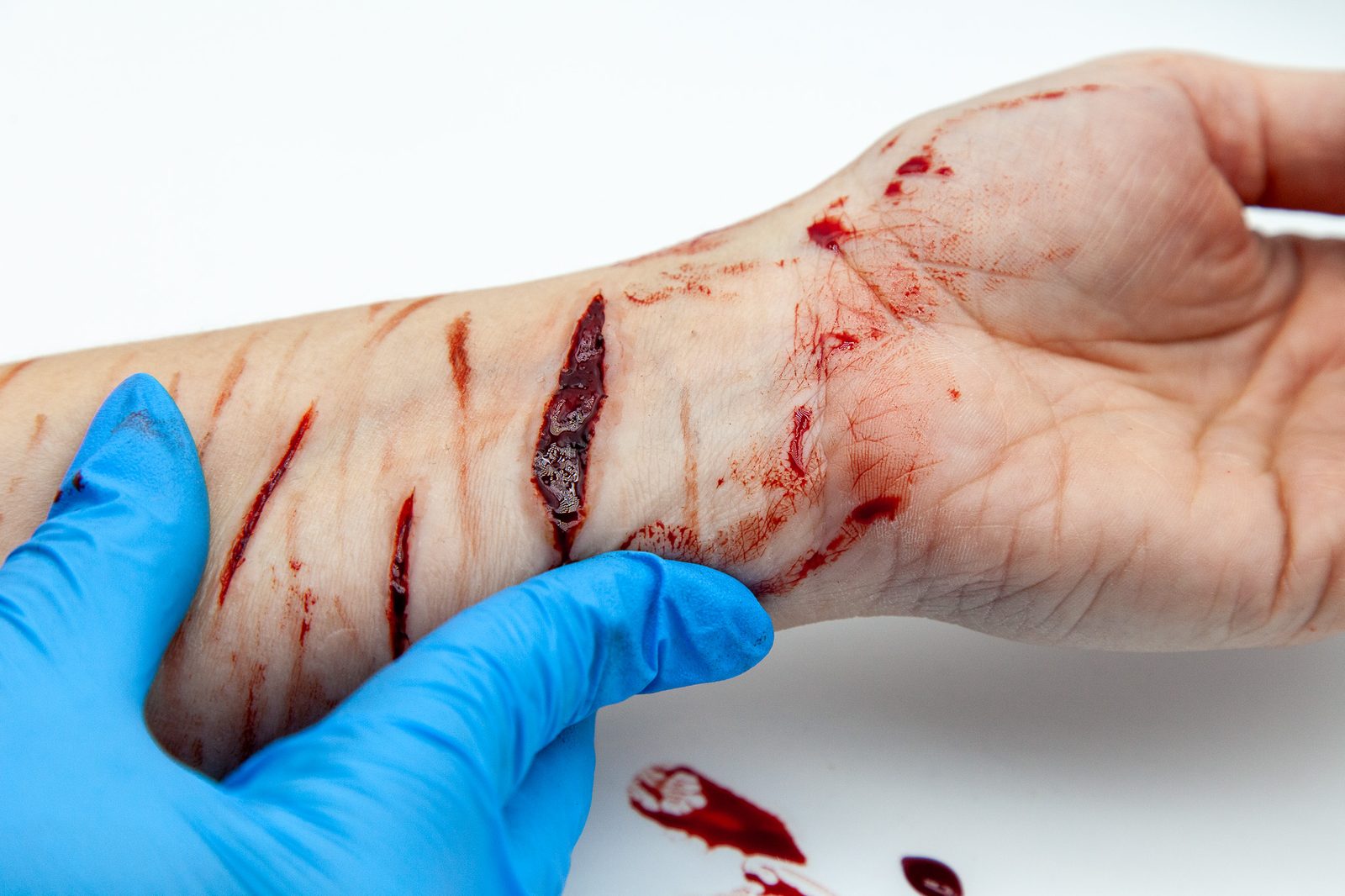 Incised wounds moulage to the forearm and hand, with blood detail