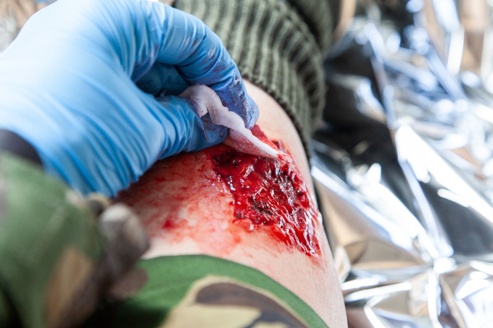 Abrasion and laceration moulage to a shoulder being blotted with a swab, the casualty wrapped in a foil survival blanket
