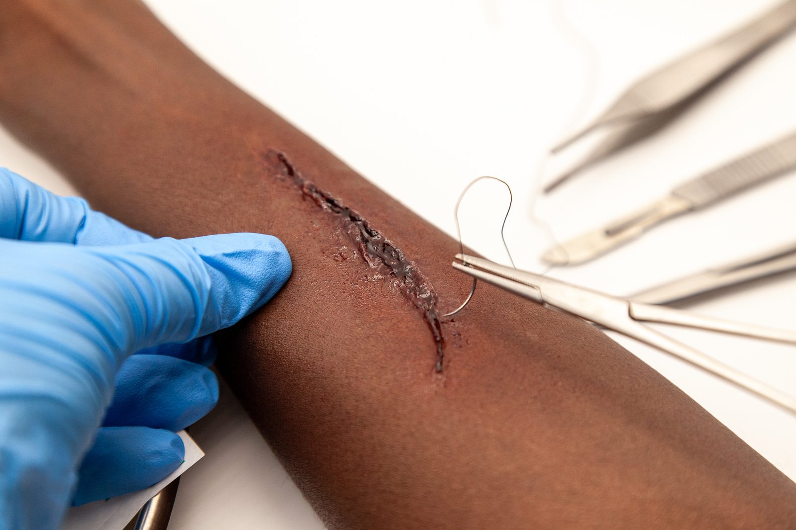 Incised wound moulage on a forearm with a suture needle and thread at the wound edge, forceps and a scalpel laid out alongside